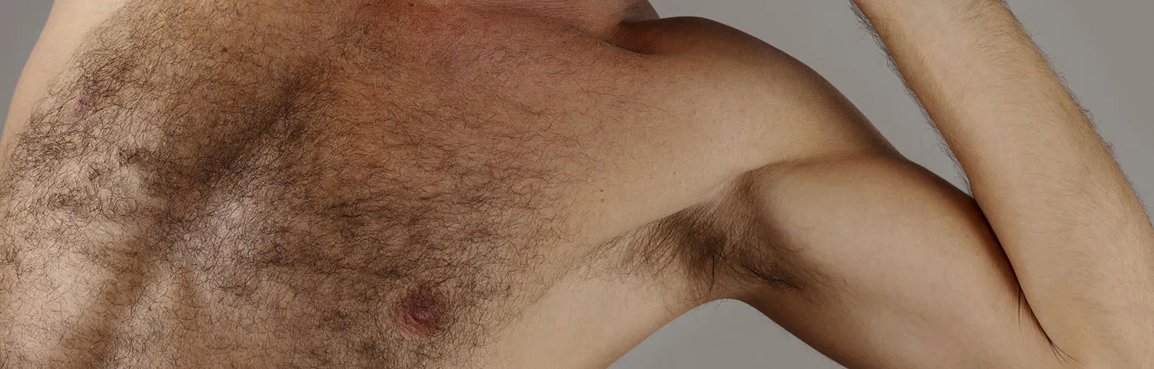 haarentferung bei männern haus medicus